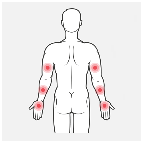 Easy Ergonomics 23 Ergonomie armklachten polsklachten